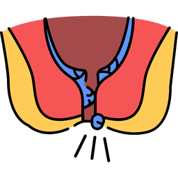 Hemorrhoid symptoms